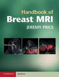 Produktbild: Handbook of Breast MRI