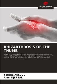 Produktbild: Rhizarthrosis Of The Thumb