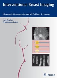 Produktbild: Interventional Breast Imaging