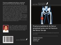 Produktbild: Fractura ipsilateral de f&eacute;mur proximal junto con la fractura de f&eacute;mur de eje