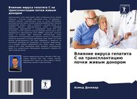 Produktbild: Vliqnie wirusa gepatita S na transplantaci&uuml; pochki zhiwym donorom
