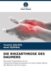 Produktbild: Die Rhizarthrose des Daumens