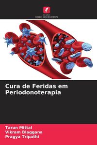 Produktbild: Cura de Feridas em Periodonoterapia