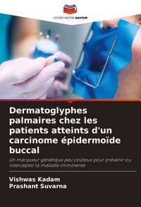 Produktbild: Dermatoglyphes palmaires chez les patients atteints d'un carcinome &eacute;pidermo&iuml;de buccal