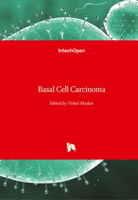 Produktbild: Basal Cell Carcinoma