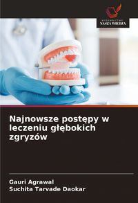 Produktbild: Najnowsze post&iquest;py w leczeniu g&iquest;&iquest;bokich zgryz&oacute;w