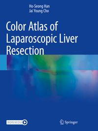 Produktbild: Color Atlas of Laparoscopic Liver Resection
