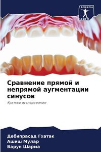 Produktbild: Srawnenie prqmoj i neprqmoj augmentacii sinusow