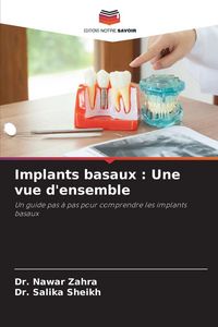 Produktbild: Implants basaux : Une vue d'ensemble
