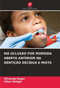 Produktbild: M&aacute; Oclus&atilde;o Por Mordida Aberta Anterior Na Denti&ccedil;&atilde;o Dec&iacute;dua E Mista