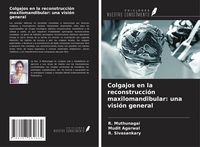 Produktbild: Colgajos en la reconstrucci&oacute;n maxilomandibular: una visi&oacute;n general