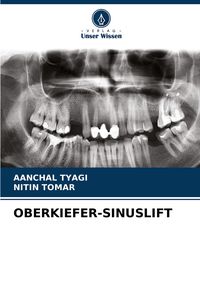Produktbild: Oberkiefer-Sinuslift