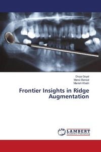Produktbild: Frontier Insights in Ridge Augmentation