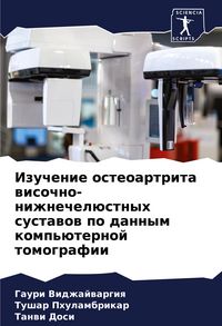 Produktbild: Izuchenie osteoartrita wisochno-nizhnechel&uuml;stnyh sustawow po dannym komp'&uuml;ternoj tomografii