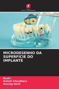 Produktbild: Microdesenho Da Superf&iacute;cie Do Implante