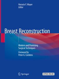 Produktbild: Breast Reconstruction