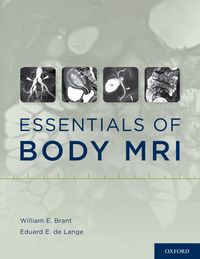 Produktbild: Essentials of Body MRI