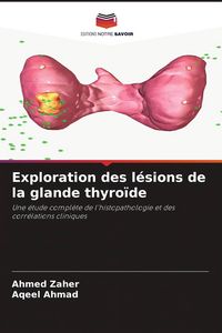 Produktbild: Exploration des l&eacute;sions de la glande thyro&iuml;de