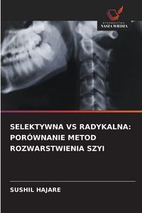 Produktbild: Selektywna Vs Radykalna: Por&oacute;wnanie Metod Rozwarstwienia Szyi