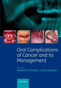 Produktbild: Oral Complications Of Cancer &