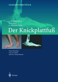 Produktbild: Fussdeformit&Auml;ten