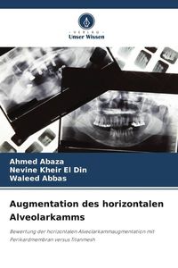 Produktbild: Augmentation des horizontalen Alveolarkamms
