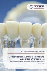 Produktbild: Contemporary Concepts in Implant-Supported Overdentures