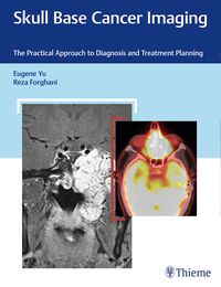 Produktbild: Skull Base Cancer Imaging