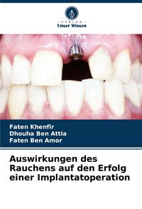 Produktbild: Auswirkungen des Rauchens auf den Erfolg einer Implantatoperation