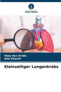 Produktbild: Kleinzelliger Lungenkrebs
