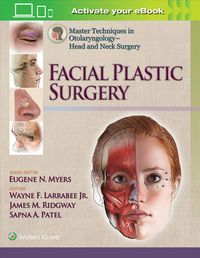 Produktbild: Larrabee, W: Master Techniques in Otolaryngology - Head and