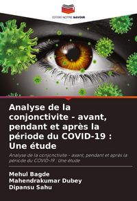 Produktbild: Analyse de la conjonctivite - avant, pendant et apr&egrave;s la p&eacute;riode du COVID-19 : Une &eacute;tude