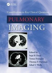 Produktbild: Desai, S: Pulmonary Imaging