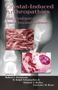 Produktbild: Crystal-Induced Arthropathies