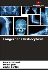 Produktbild: Langerhans histiocytosis