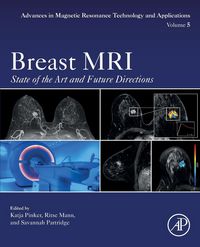 Produktbild: Breast MRI