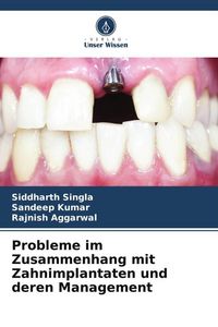 Produktbild: Probleme im Zusammenhang mit Zahnimplantaten und deren Management