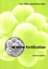 Produktbild: Elder, K: In Vitro Fertilization