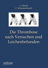 Produktbild: Eberth, C: Thrombose nach Versuchen und Leichenbefunden