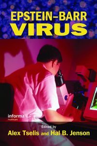Produktbild: Epstein-Barr Virus