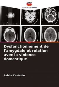 Produktbild: Dysfonctionnement de l'amygdale et relation avec la violence domestique