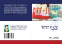 Produktbild: Rationale for Patient Selection for Dental Implants