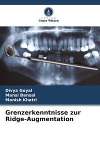 Produktbild: Grenzerkenntnisse zur Ridge-Augmentation