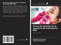 Produktbild: Cierre de espacios en la mec&aacute;nica de tratamiento MBT