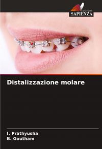 Produktbild: Distalizzazione molare