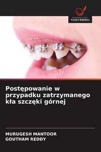 Produktbild: Post&iquest;powanie w przypadku zatrzymanego k&iquest;a szcz&iquest;ki g&oacute;rnej
