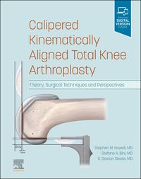 Produktbild: Calipered Kinematically aligned Total Knee Arthroplasty E-Book