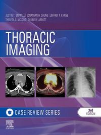 Produktbild: Thoracic Imaging: Case Review Series E-Book