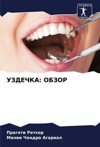 Produktbild: Uzdechka: Obzor
