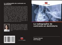 Produktbild: La radiographie de contraste en dentisterie